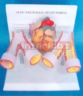 HEART AND DISEASE ARTERY MODELS